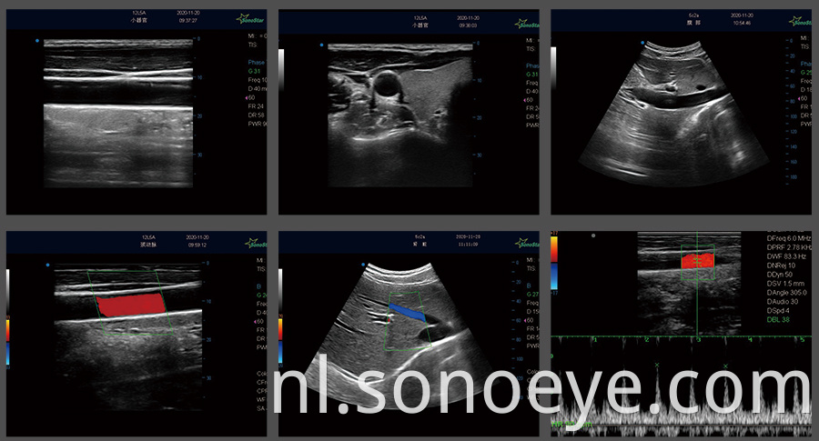 mini ultrasound